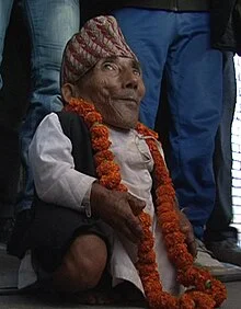 11. The Shortest Human Was 21 Inches Tall